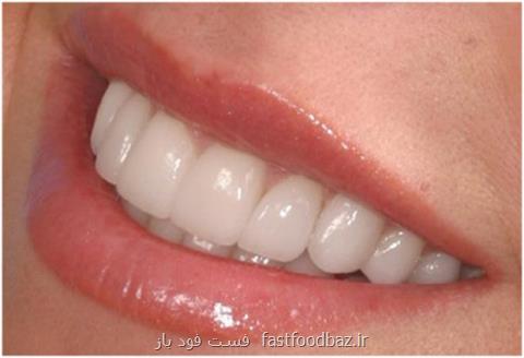 متخصصان توصیه می کنند؛ مواد خوراکی مفید برای داشتن دندان های سالم را بشناسیم