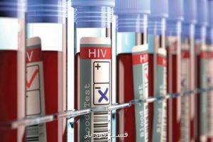 خطر مشکلات قلبی برای افراد آلوده به اچ آی وی