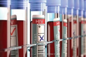 یک آزمایش امیدبخش برای مقابله با ویروس ایدز