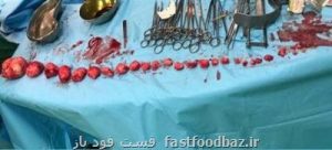 خارج کردن ۲۷ توده از رحم دختر ۳۹ ساله بندرعباسی