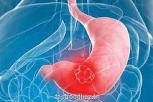 یک فوق تخصص گوارش و کبد تاکید کرد؛ تبعات مصرف بی رویه آنتی بیوتیک ها