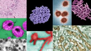 بیماریهای غیرواگیر، قاتل جهانی هستند