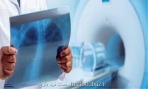 دبیر انجمن رادیولوژی ایران: کمبود نیروی انسانی مانع پیشرفت نظام سلامت می شود