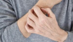 چگونه خشکی پوست را کاهش دهیم؟