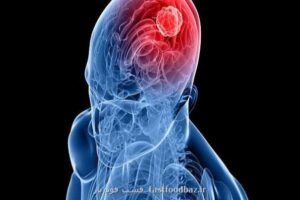 محققان فرانسوی هشدار می دهند؛ ارتباط داروهای هورمونی ضد حاملگی با تومورهای مغزی