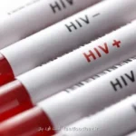 آغاز پویش من هم تست HIV می دهم از امروز تا ۲۰ آذرماه