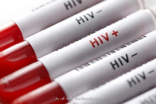 آغاز پویش من هم تست HIV می دهم از امروز تا 20 آذرماه