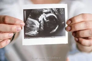 حمایت روانی، مهم ترین عامل ادامه حاملگی است