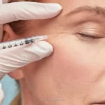 تزریق بوتاکس و مزایای آن